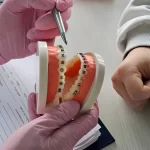 How to Choose a Safe Dental Clinic and Avoid Fake Braces? Step by Step Guide